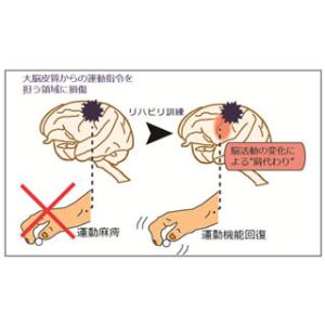 诱发脑梗塞的因素有哪些